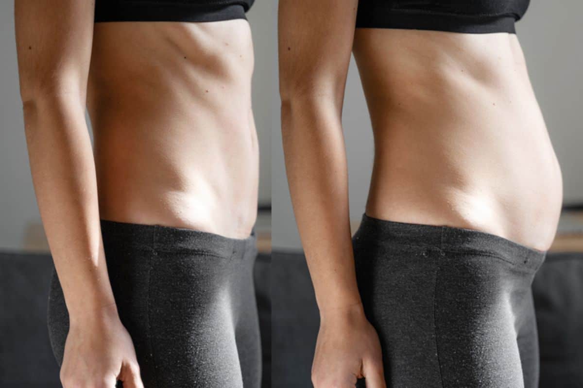 How long does diastasis recti take to improve Derby?