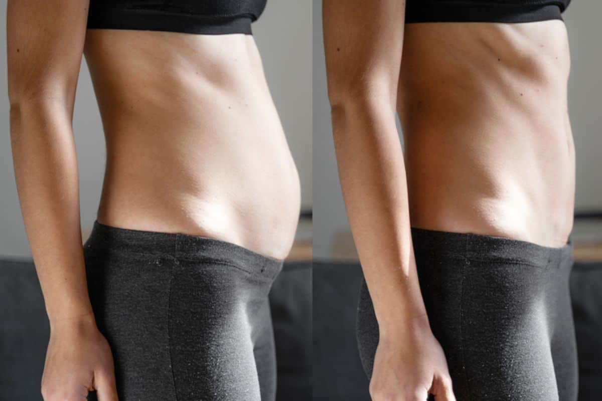 Post-Pregnancy: What Happens to Your Abdominal Muscles After Birth Derby