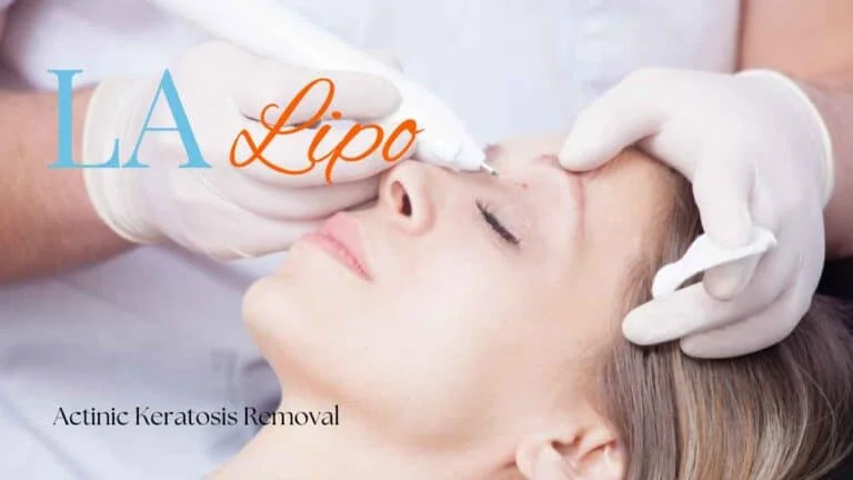 Woman receiving Actinic Keratosis Removal Treatment Derby
