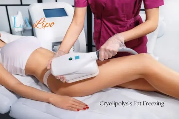 Woman receiving coolsculpting Derby treatment on her thighs