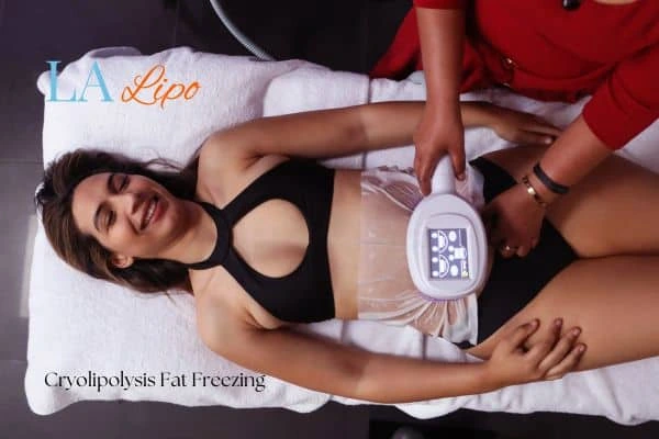 woman getting cryolipolysis Derby