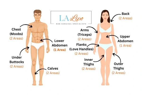 LA LIPO Cryolipolysis Areas Derby