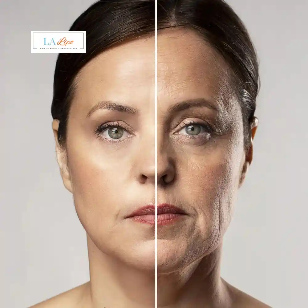 How Can You Tell If Non-Surgical Skin Tightening Is Right for You Derby?