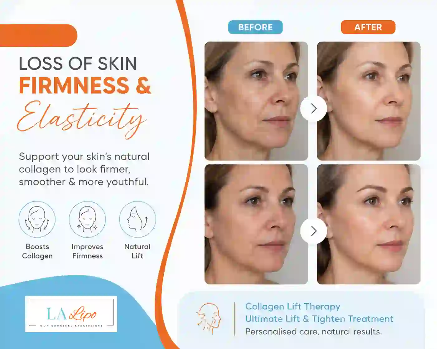 Sign #7: Loss of Skin Firmness and Elasticity Derby